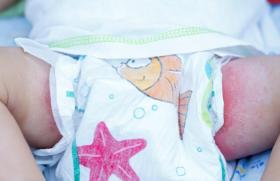 Чем лечить сильные опрелости у новорожденного ребенка: лучшие средства для обработки кожи грудничка в домашних условиях Лечение опрелости у грудничков
